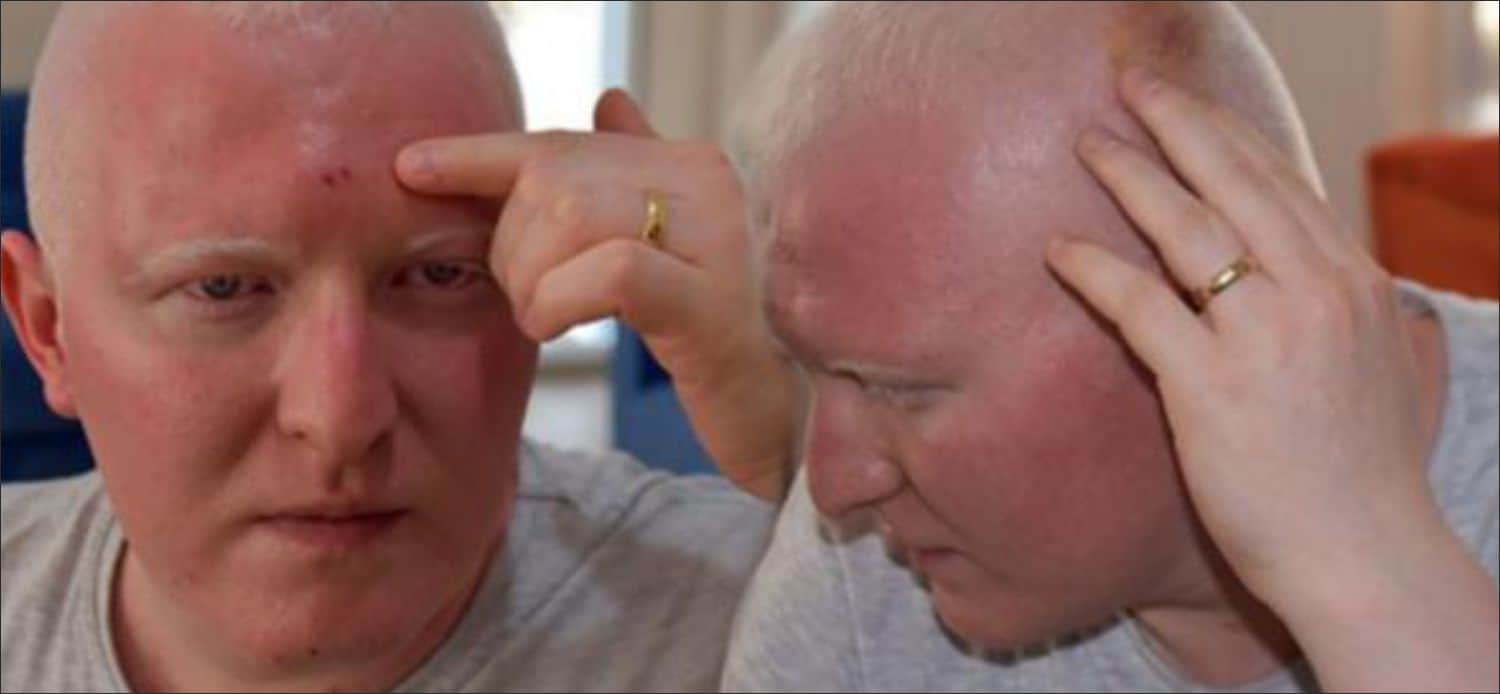 Edirne’de, yüzde 50 görme engelli Berkay Ömer Ünal (25), ücretsiz